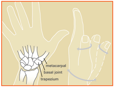 Arthritis: Base of the Thumb Dr. Neal Labana Orthopedic Hand Surgeon Ilinois: Flossmoor, Bourbonnais & Mokena Indiana: Munster